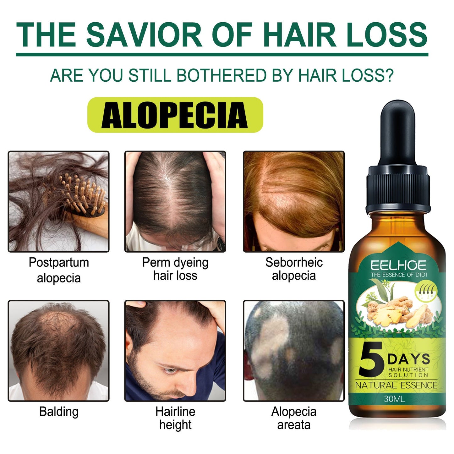 Eelhoe Ginger Hair Essential Oil: Awaken Your Roots, Unleash Rapid Growth