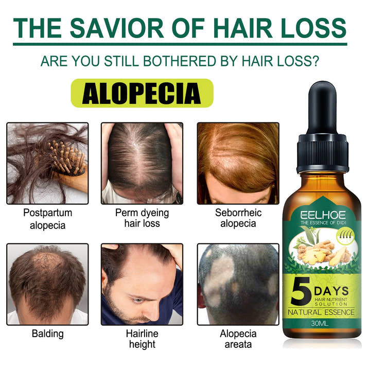 Eelhoe Ginger Hair Essential Oil: Awaken Your Roots, Unleash Rapid Growth