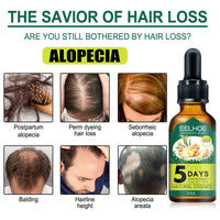 Eelhoe Ginger Hair Essential Oil: Awaken Your Roots, Unleash Rapid Growth