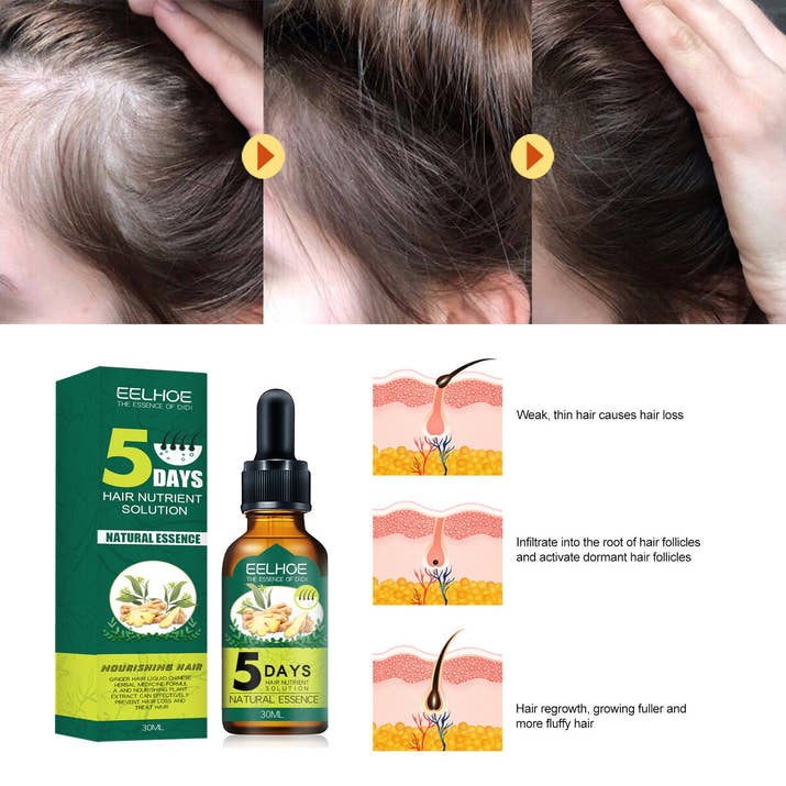 Eelhoe Ginger Hair Essential Oil: Awaken Your Roots, Unleash Rapid Growth
