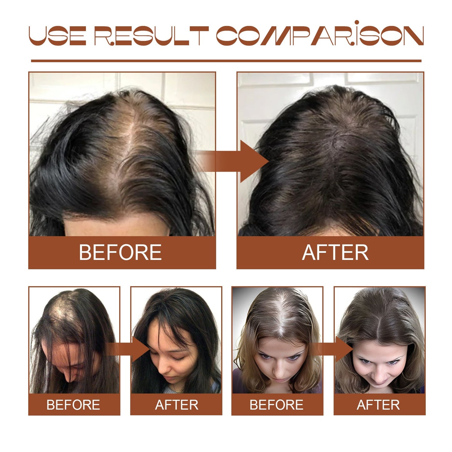 EELHOE Batana Oil Conditioner: The 2-Minute Miracle for Jungle-Strong, Silk-Soft Hair